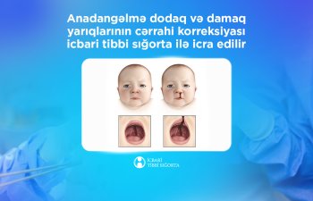 Anadangəlmə dodaq və damaq yarıqlarının cərrahi korreksiyası icbari tibbi sığorta ilə icra edilir - İTSA